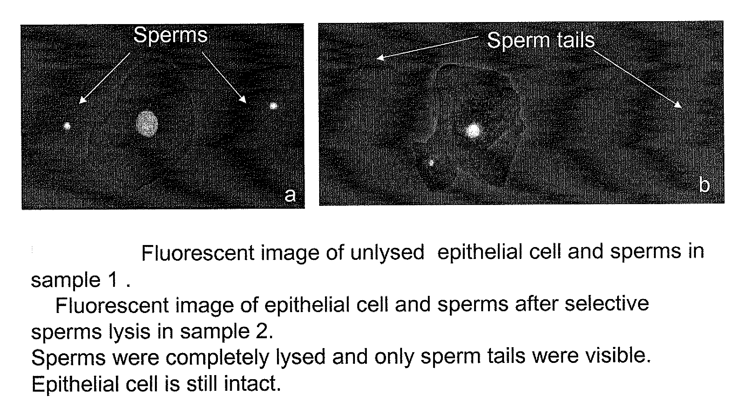 Selective Lysis of Sperm Cells