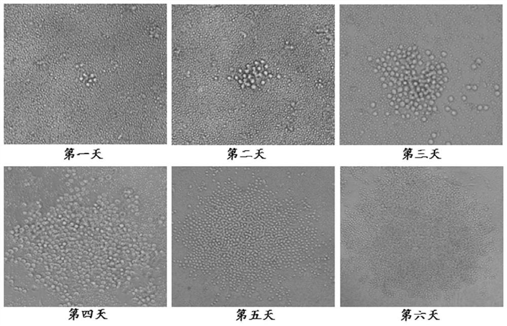 A kind of anti-hpv16 E6 protein monoclonal antibody and application thereof