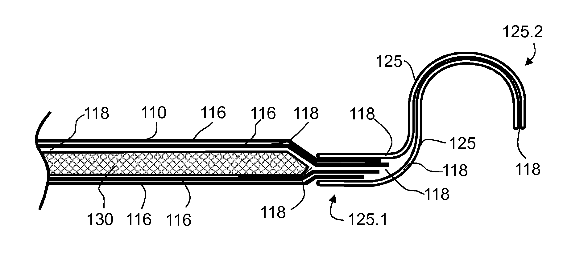 Composite component for a vehicle seat, and vehicle seat