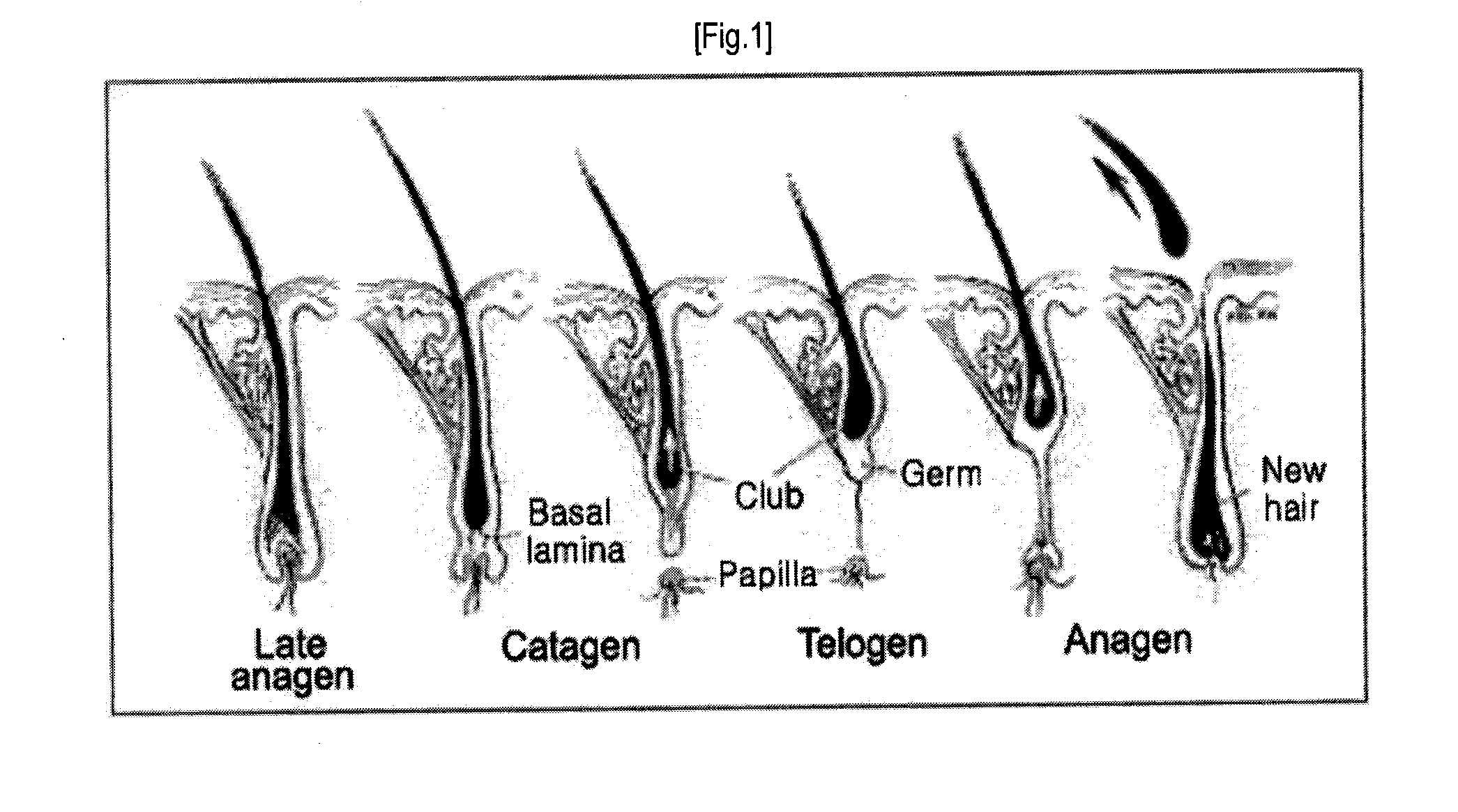 Composition for Treating Baldness with Stem Cell Derived From Umbilical Cord Blood