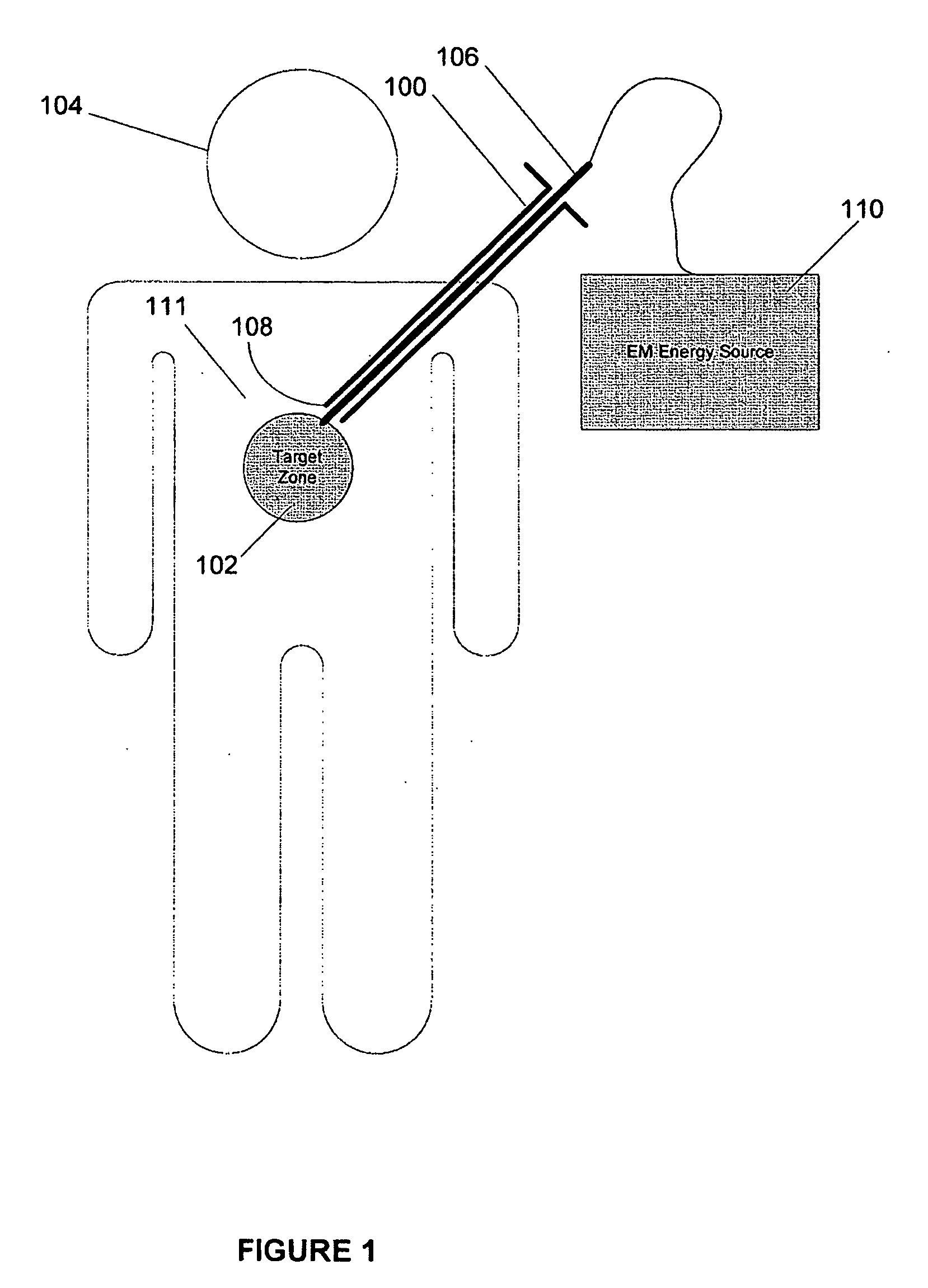 Heating via microwave and millimeter-wave transmission using a hypodermic needle