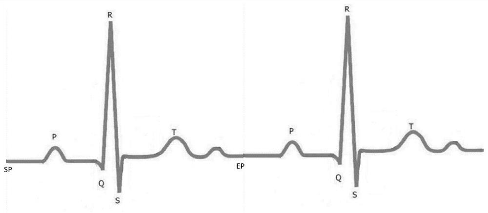 Waveform recognition method, device and equipment for electrocardiogram waveform signal