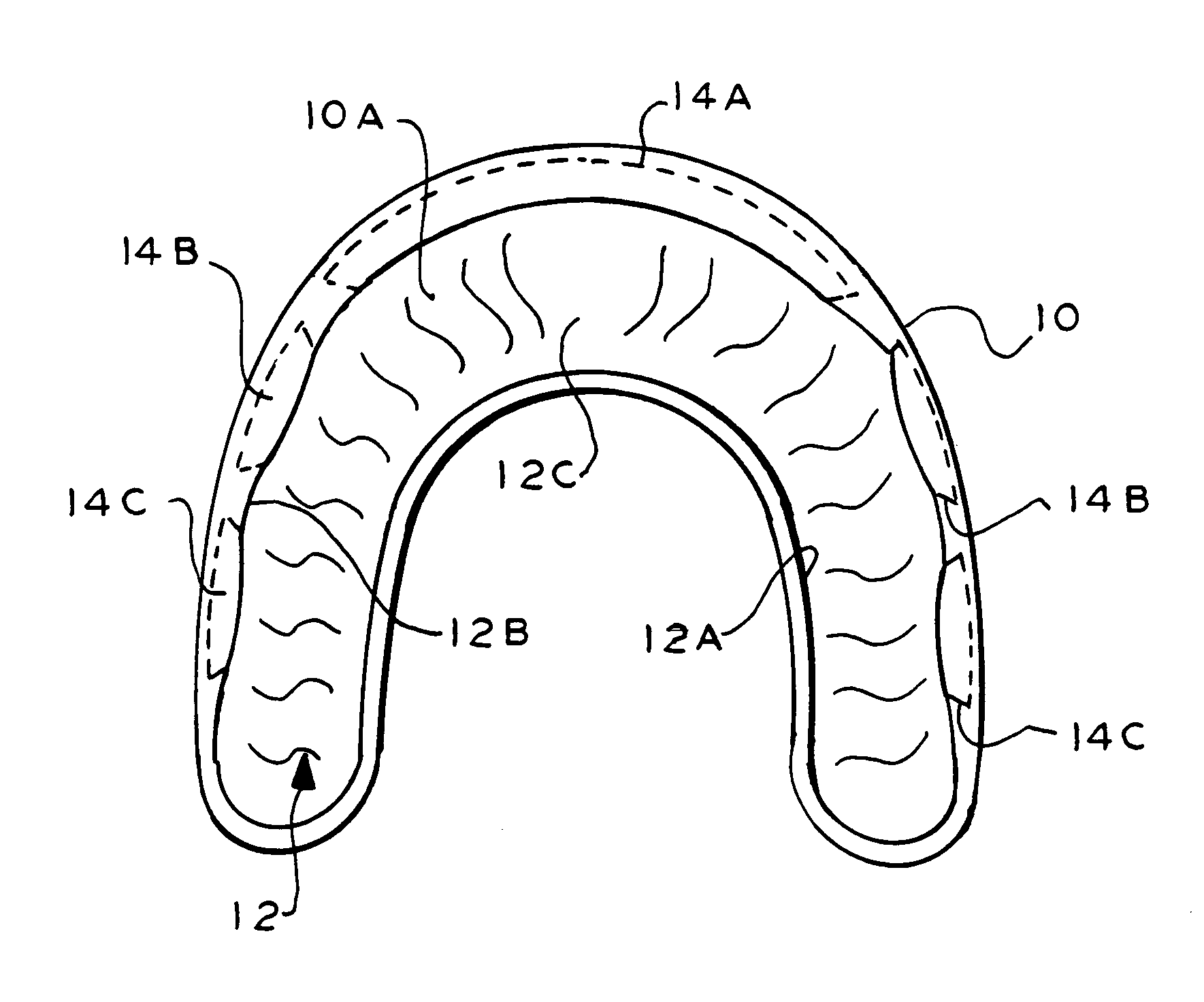 Therapeutic and protective dental device useful as an intra-oral delivery system