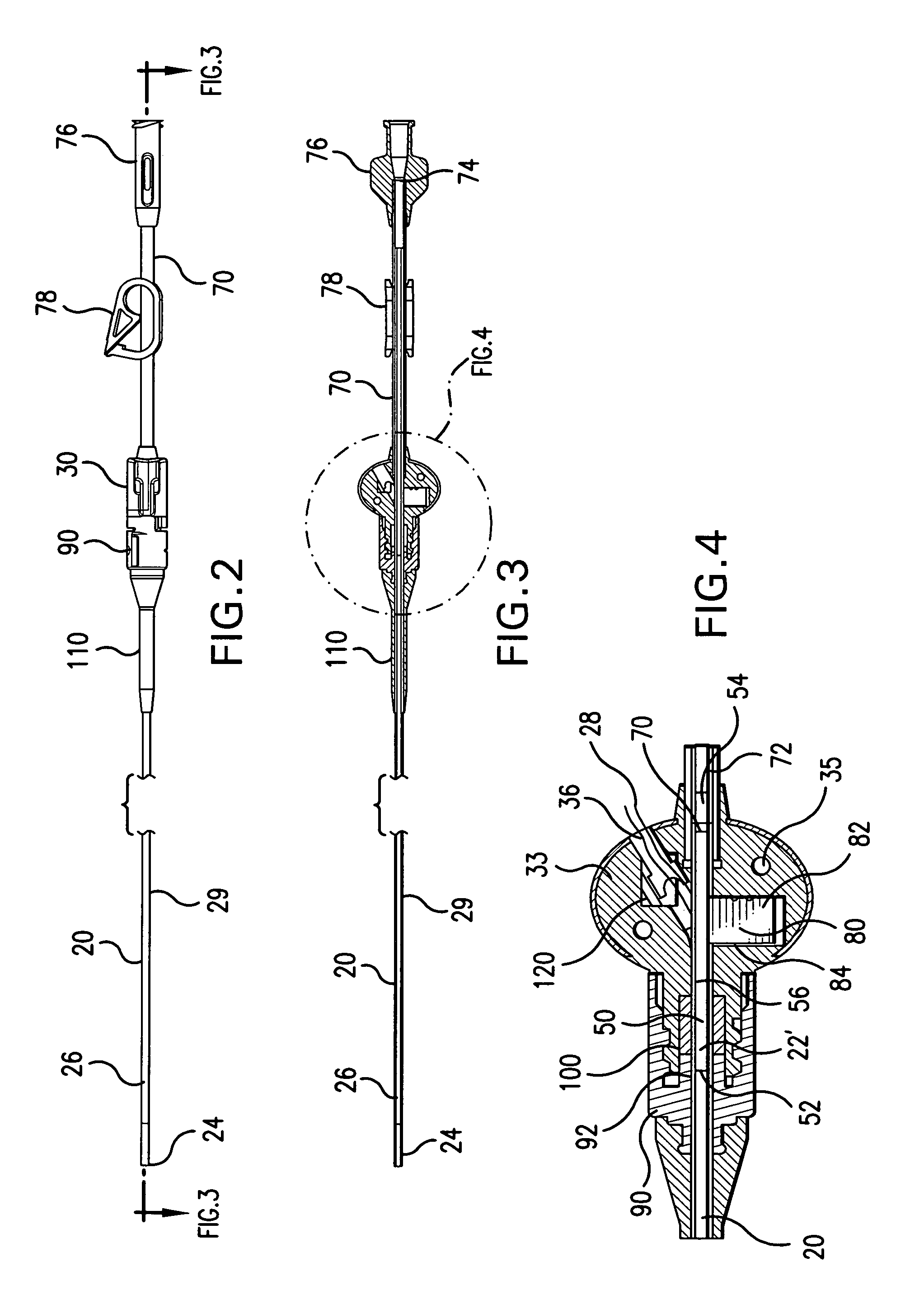 Implantable catheter and method of using same