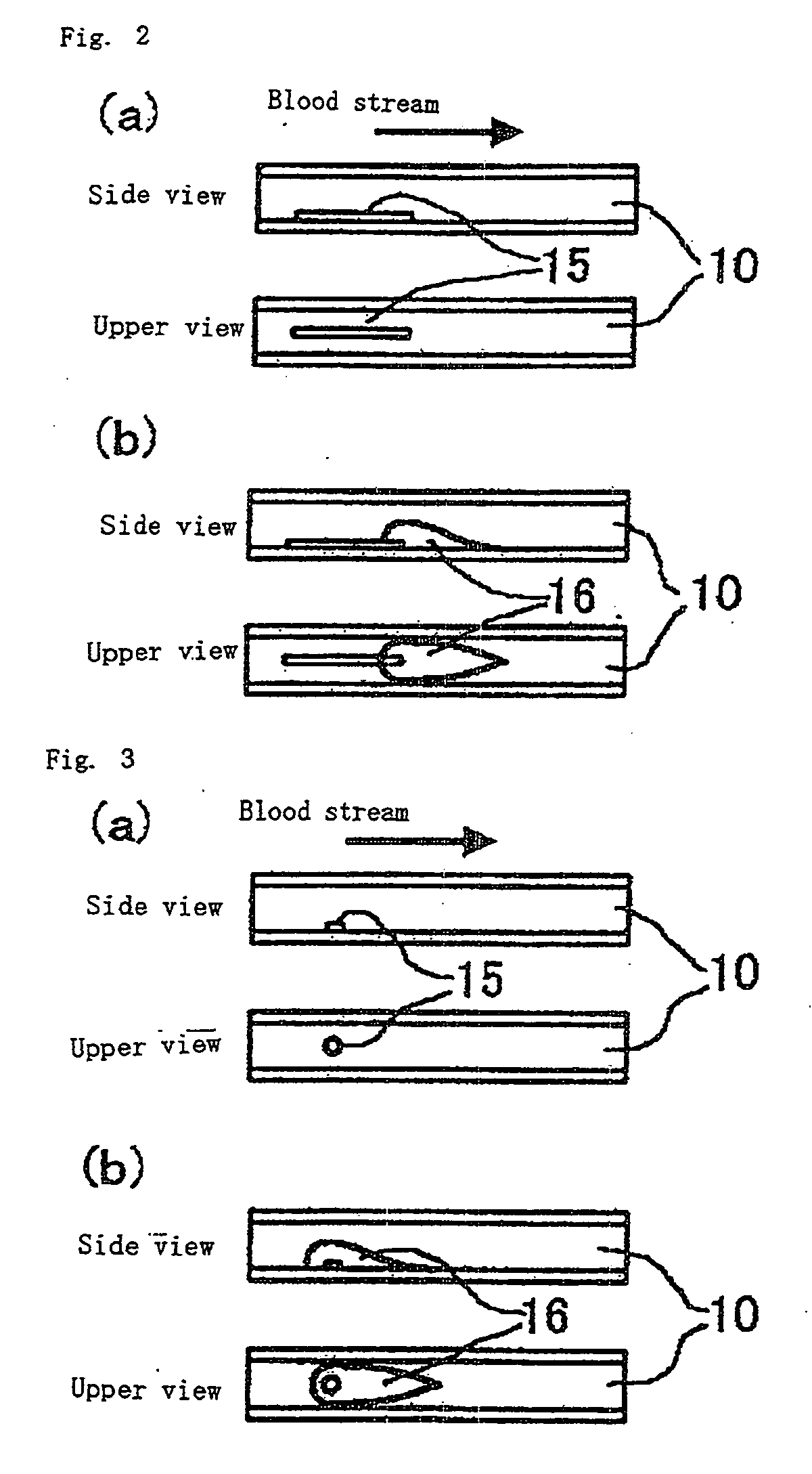 Apparatus for Monitoring Thrombus Formation and Method of Mointoring Thrombus Formation