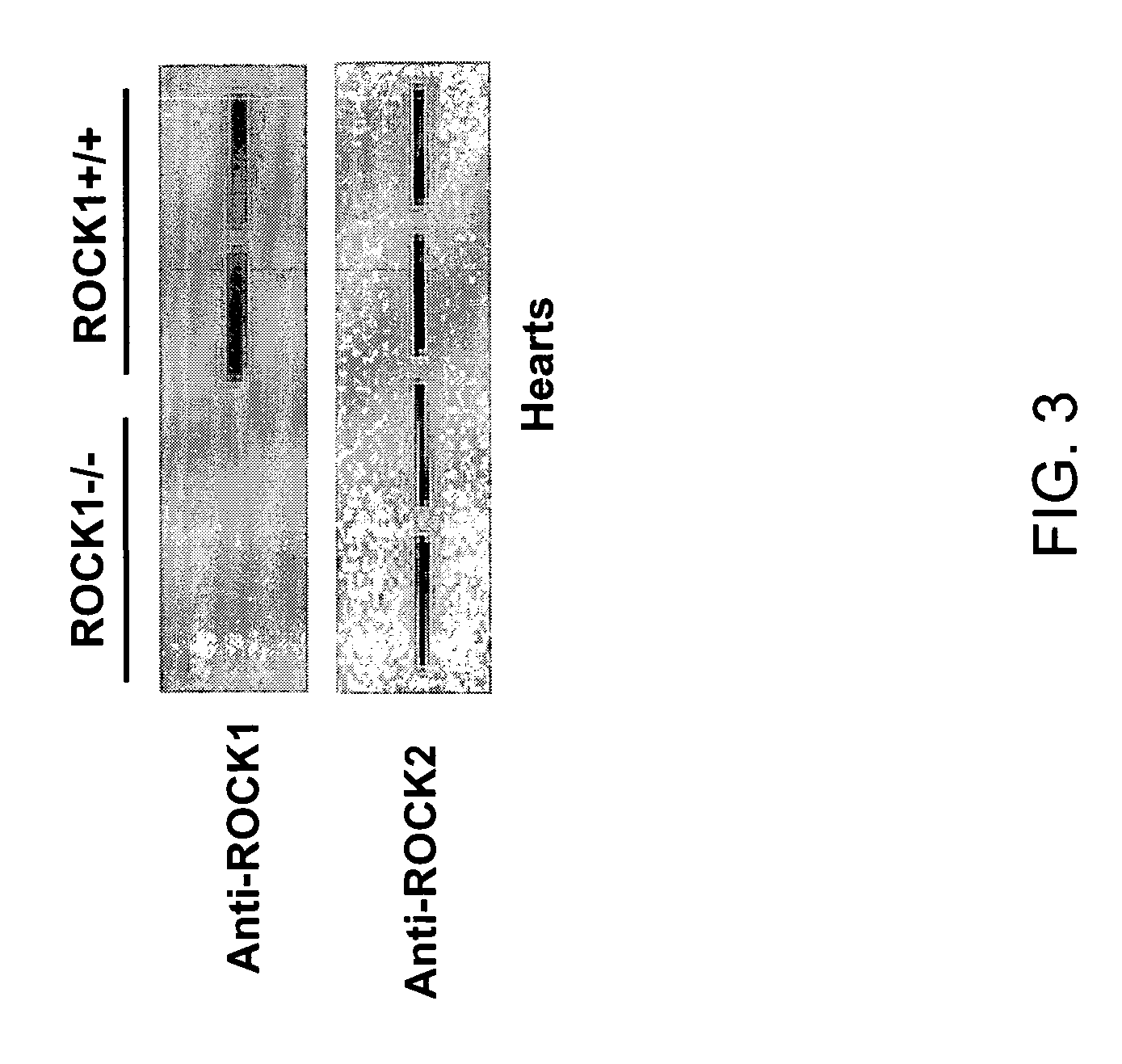 Selective inhibition of rock1 in cardiac therapy