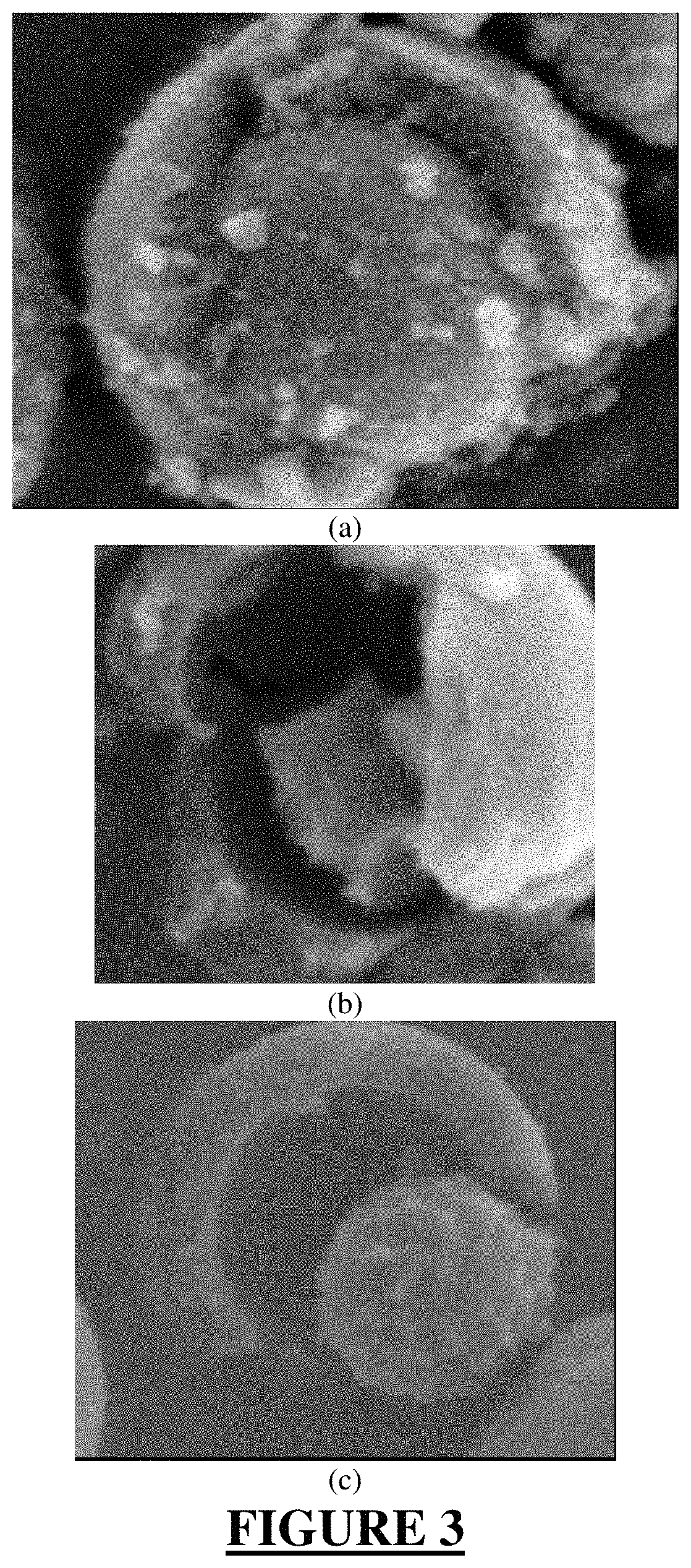 Hybrid material for chromatographic separations comprising a superficially porous core and a surrounding material