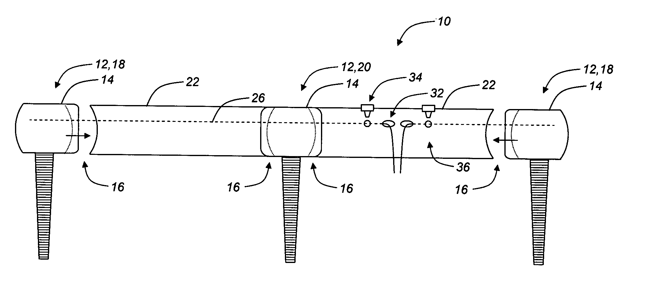 Pedicle screw-based dynamic posterior stabilization systems and methods