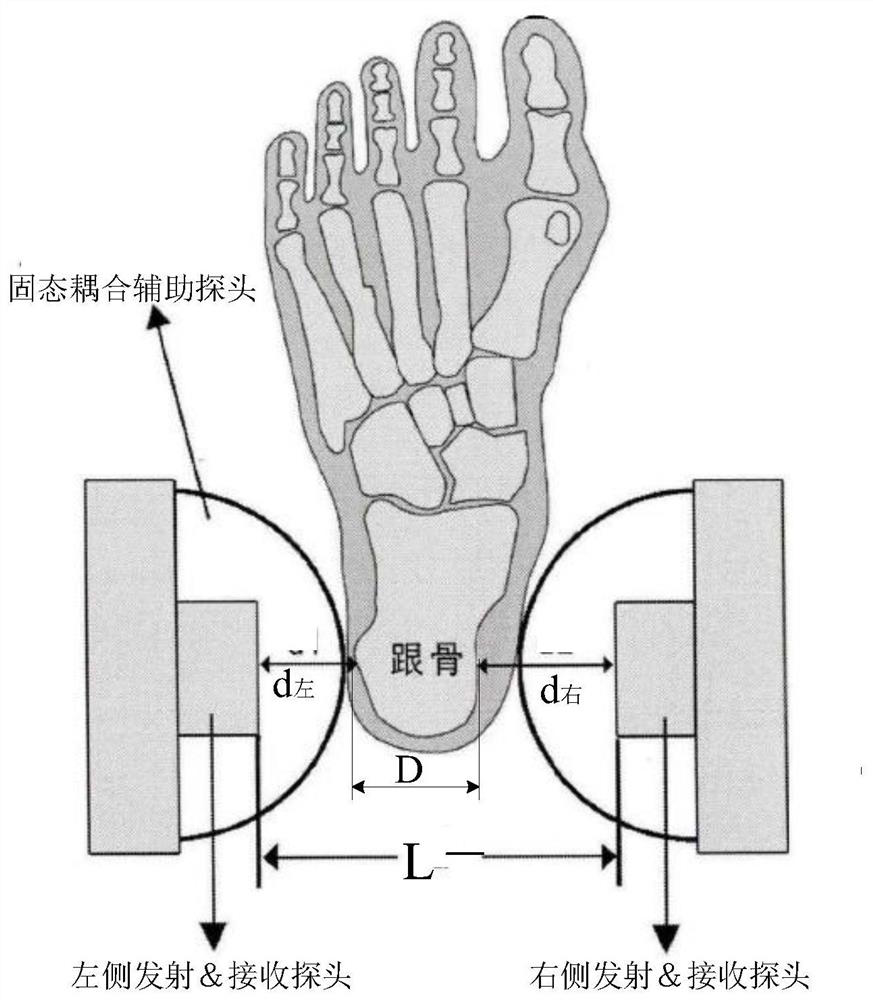 High-precision full-dry ultrasonic bone densitometer and measurement method