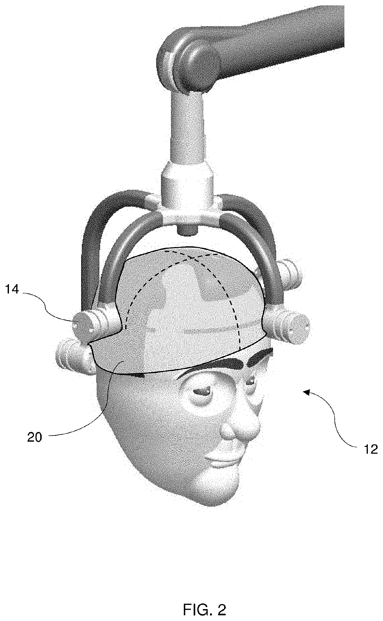 Methods of treating autism using light therapy