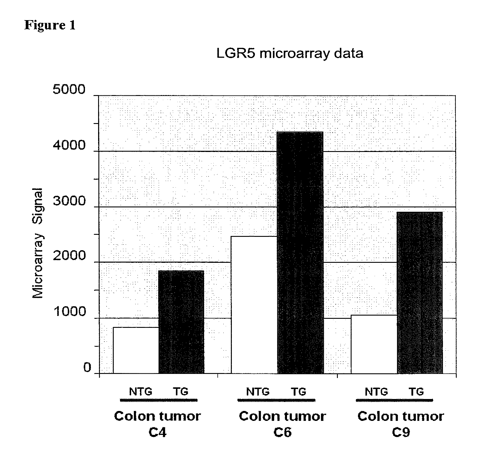 Compositions and methods for treating and diagnosing cancer