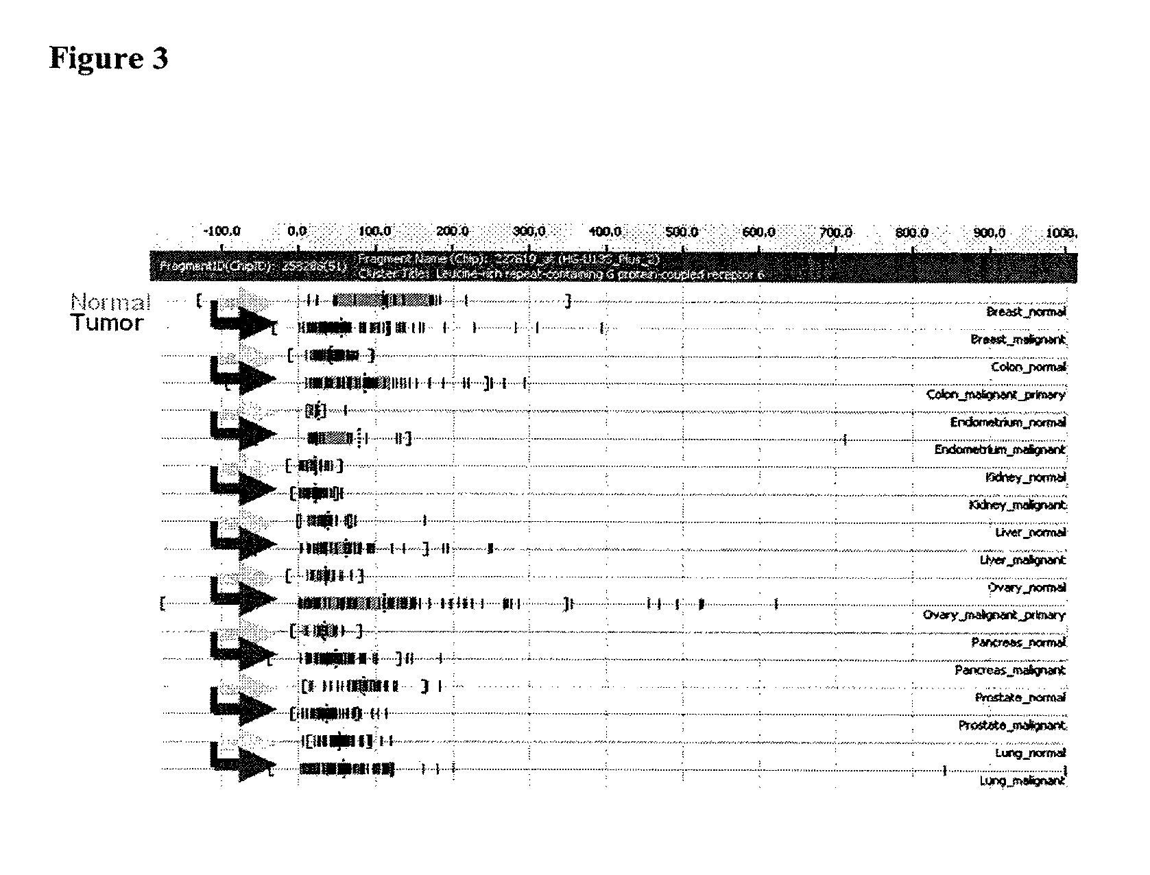 Compositions and methods for treating and diagnosing cancer