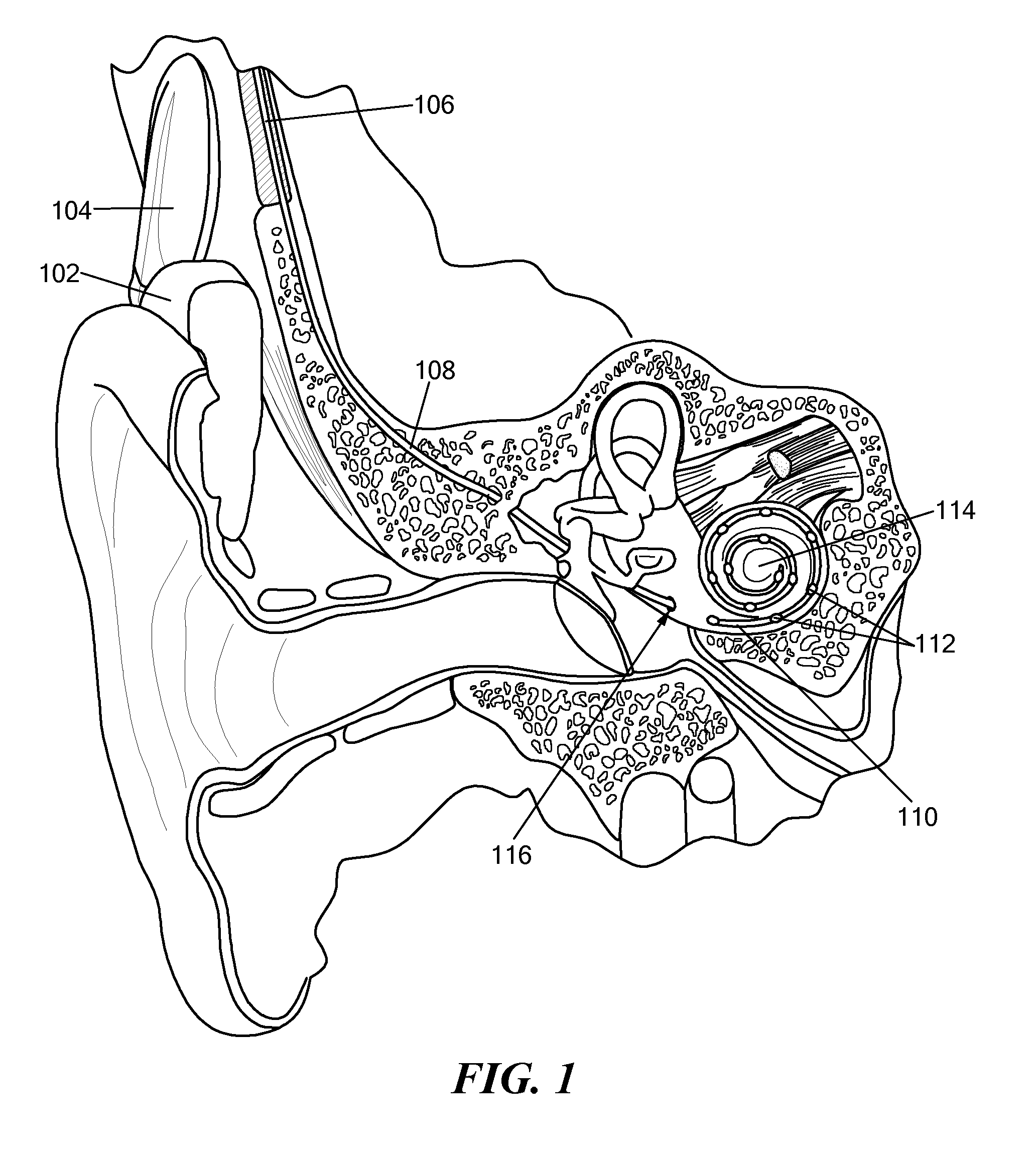 Electrode With Movable Insertion Stopper
