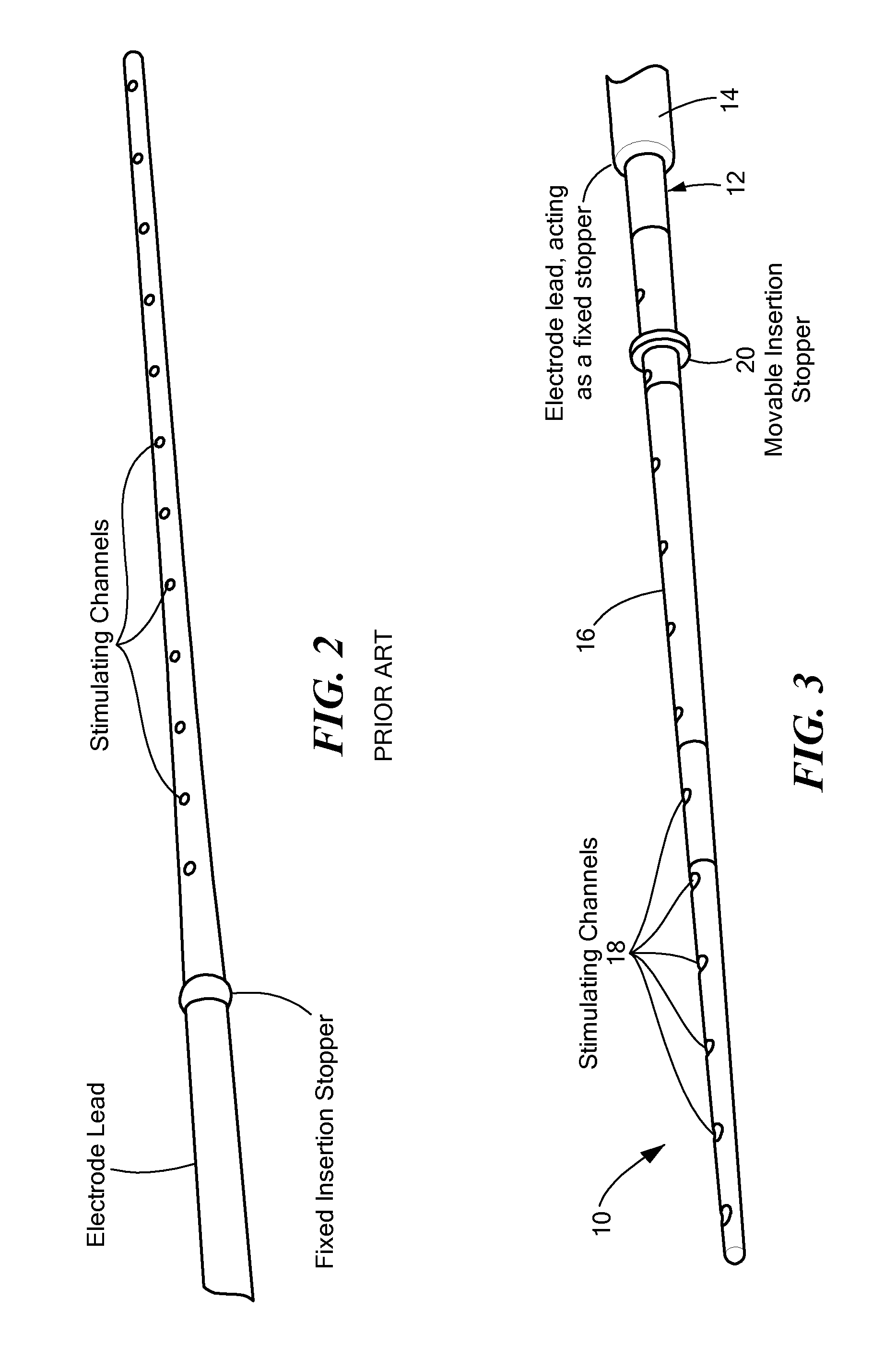 Electrode With Movable Insertion Stopper