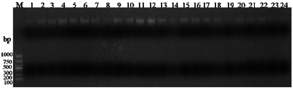 Method for detecting TCK (Tilletia controversa Kuhn) in soil through QPCR (quantitative polymerase chain reaction)