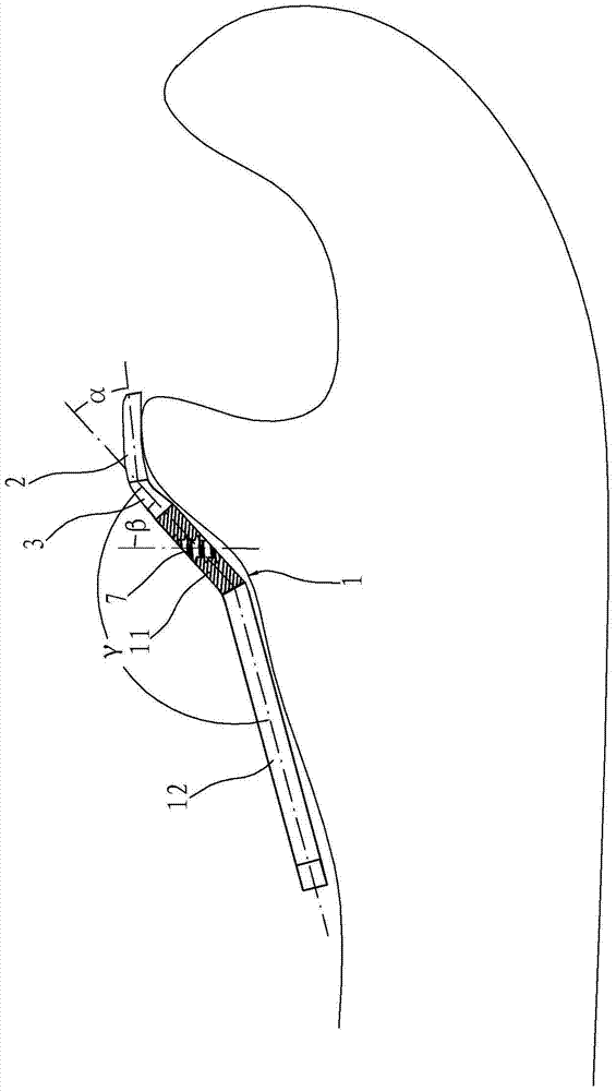 Ulnar coronoid lateral column plate