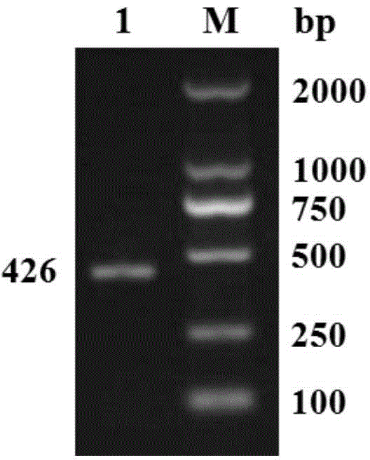 CSRP2 gene for regulating development of arterial smooth muscle of small tailed han sheep and application thereof