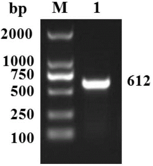 CSRP2 gene for regulating development of arterial smooth muscle of small tailed han sheep and application thereof