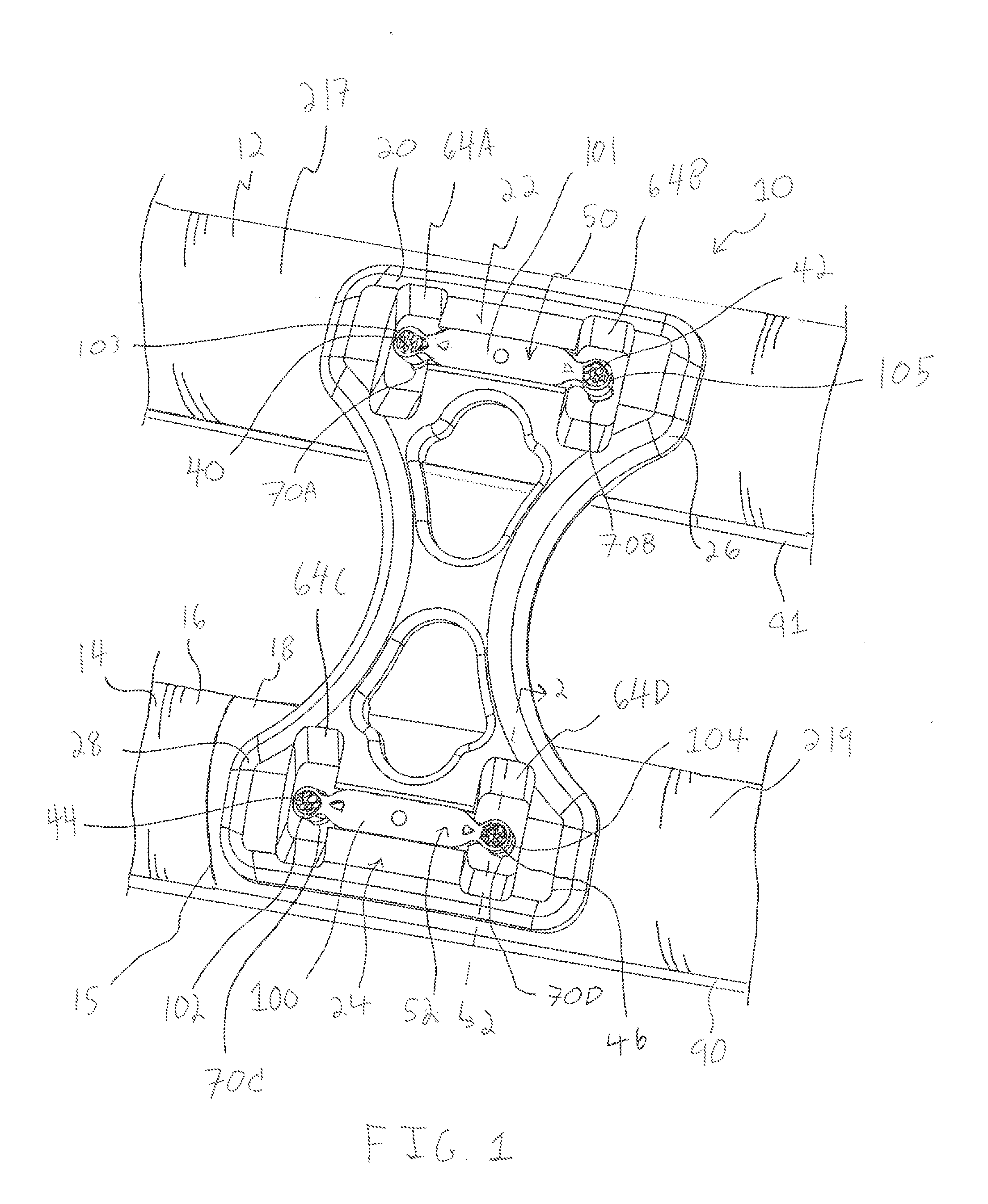 Bone plate system and method