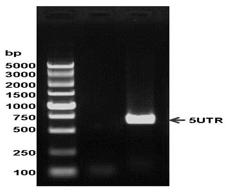 Primer used in RT-PCR detection of chicken infectious bronchitis virus, kit comprising the primer and detection method thereof