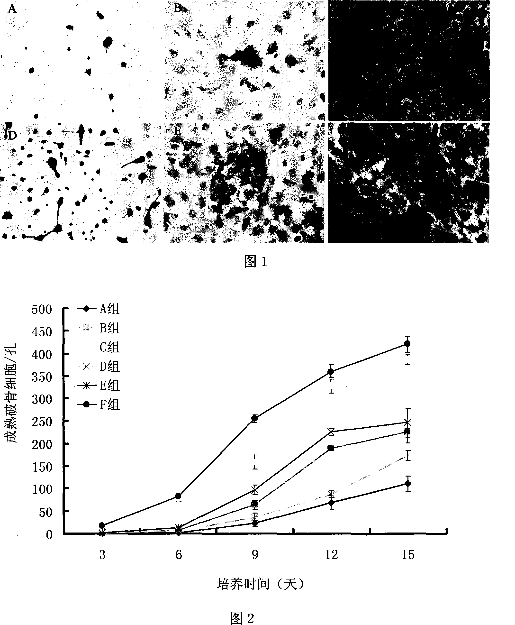 Method for culturing osteoclast with mesenchyma stem cell combined with cell factor
