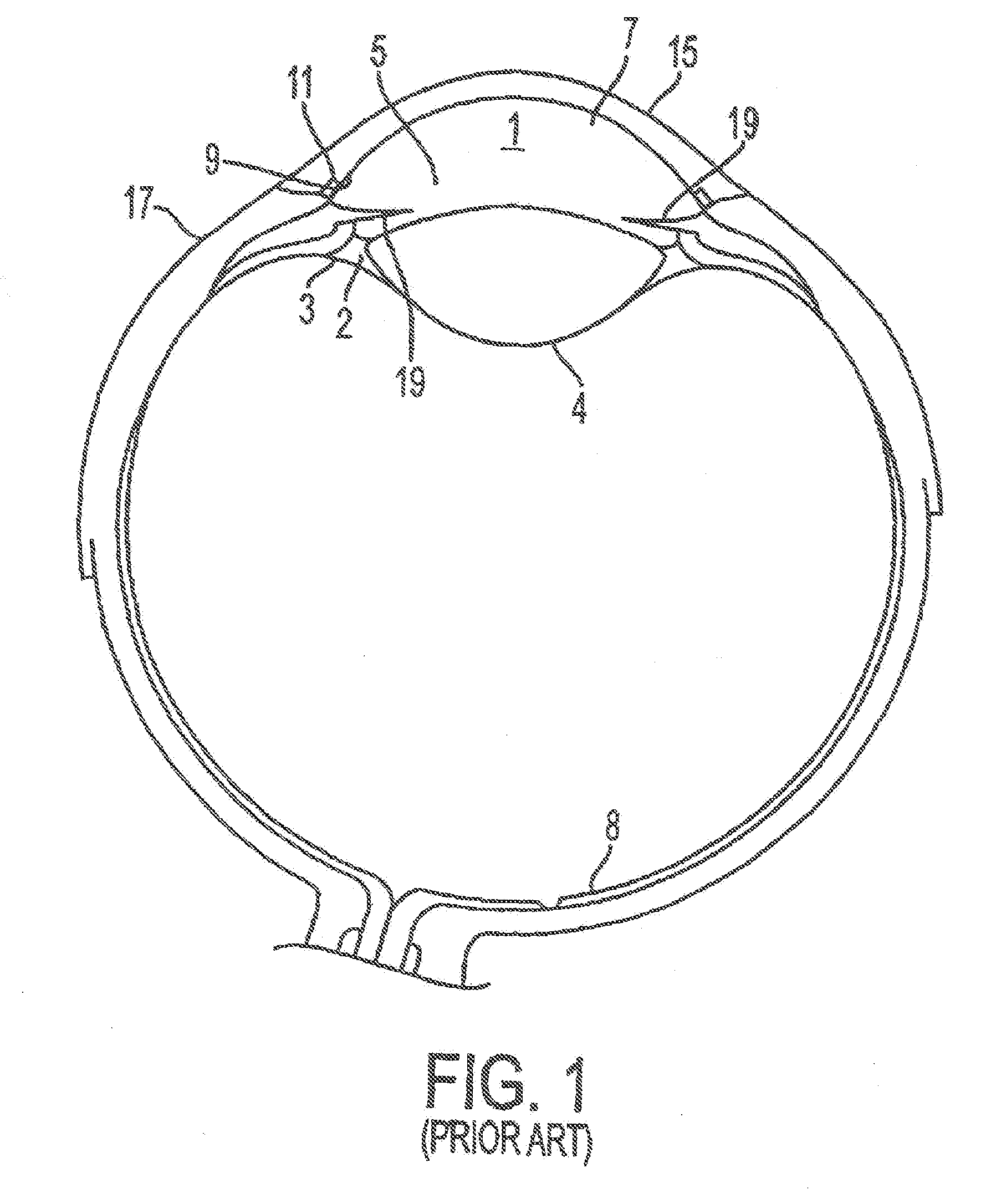 Methods and Apparatuses for the Treatment of Glaucoma using visible and infrared ultrashort laser pulses
