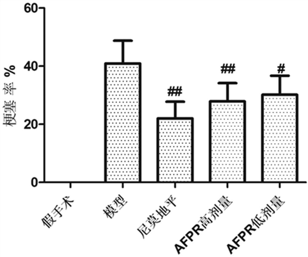 Application of polyrhachis vicina roger extract in preparation of anti-cerebral ischemia drugs