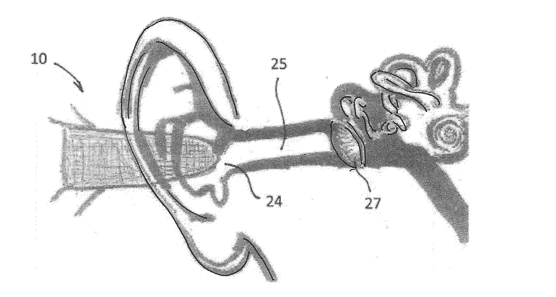 Latex-Free Finger Gauze Device For Cleaning And Drying The Ears