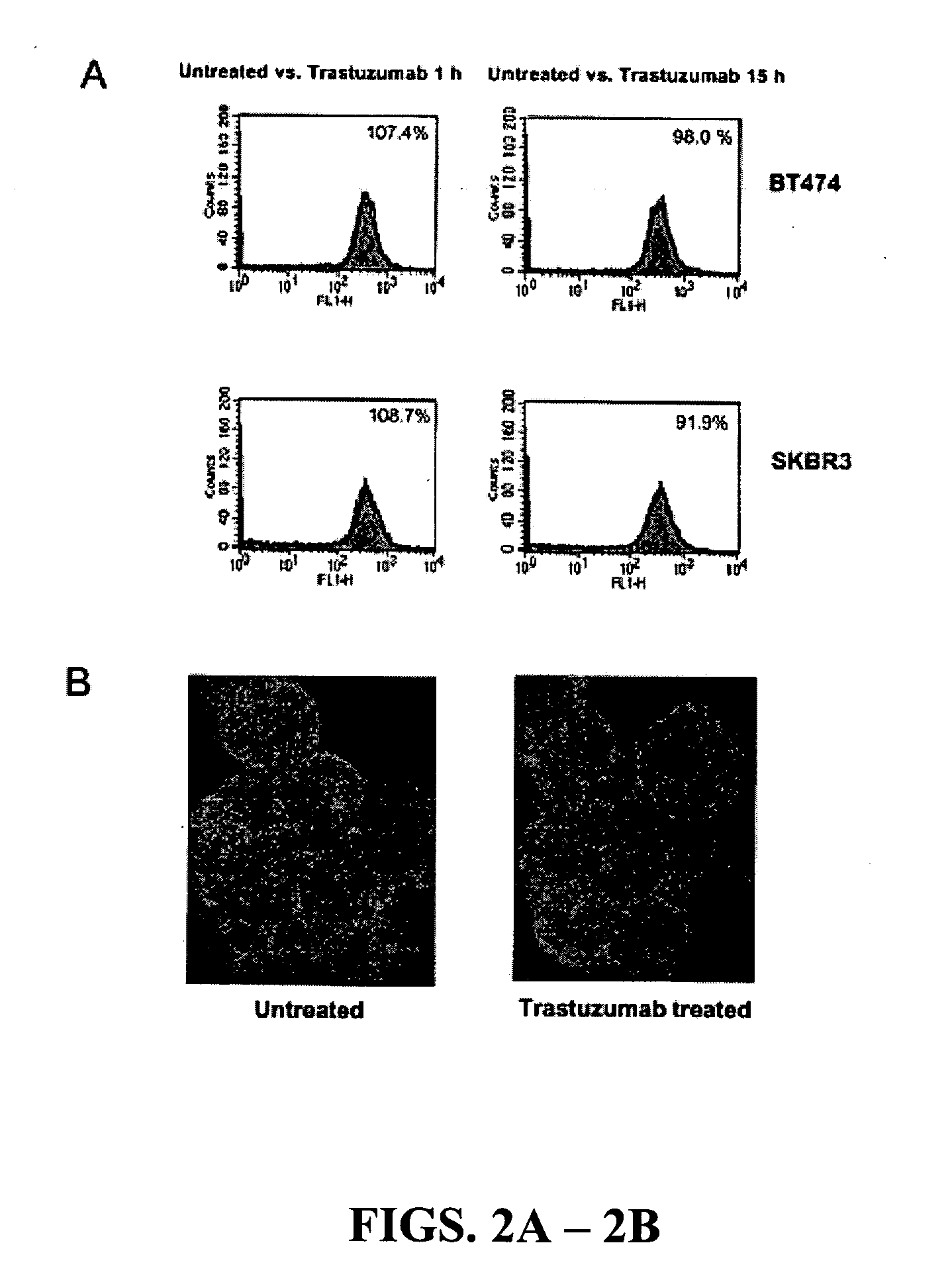 Diagnostic and therapeutic methods and compositions involving PTEN and breast cancer