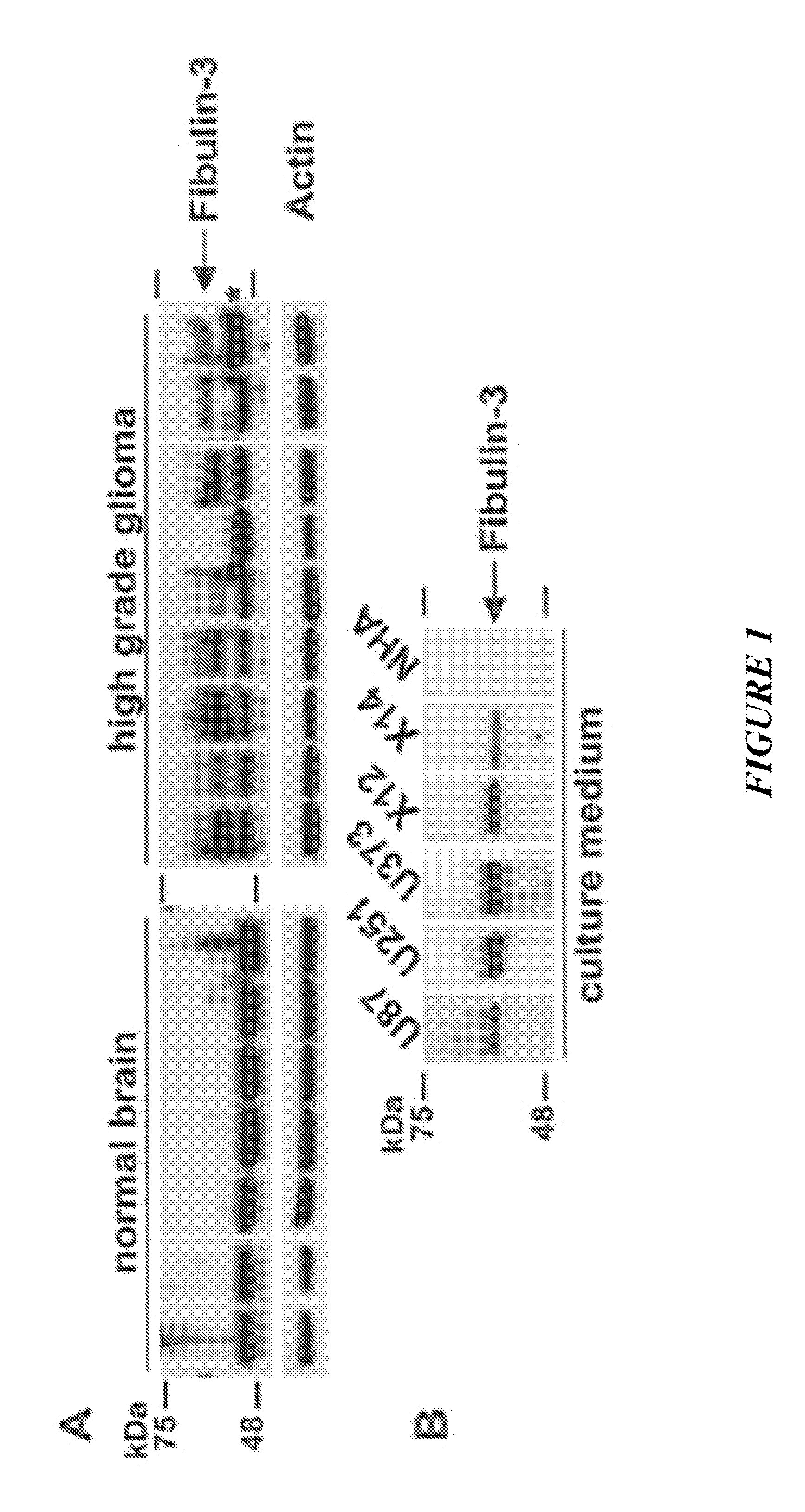 Anti-fibulin-3 antibodies and uses thereof