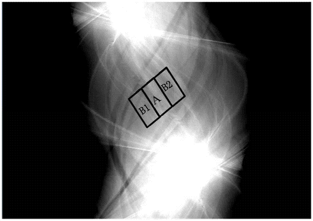 Data recovery device and method for original CT projection data, and CT imaging system