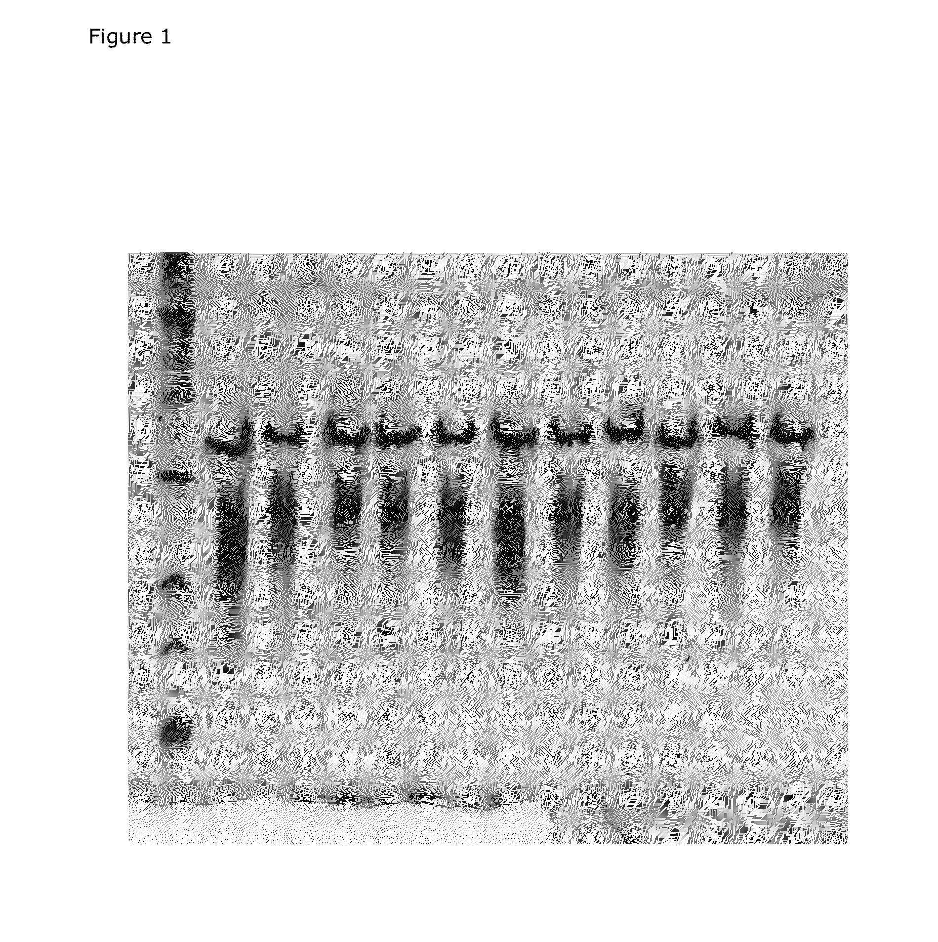 Method for Producing an Acidified Milk Drink