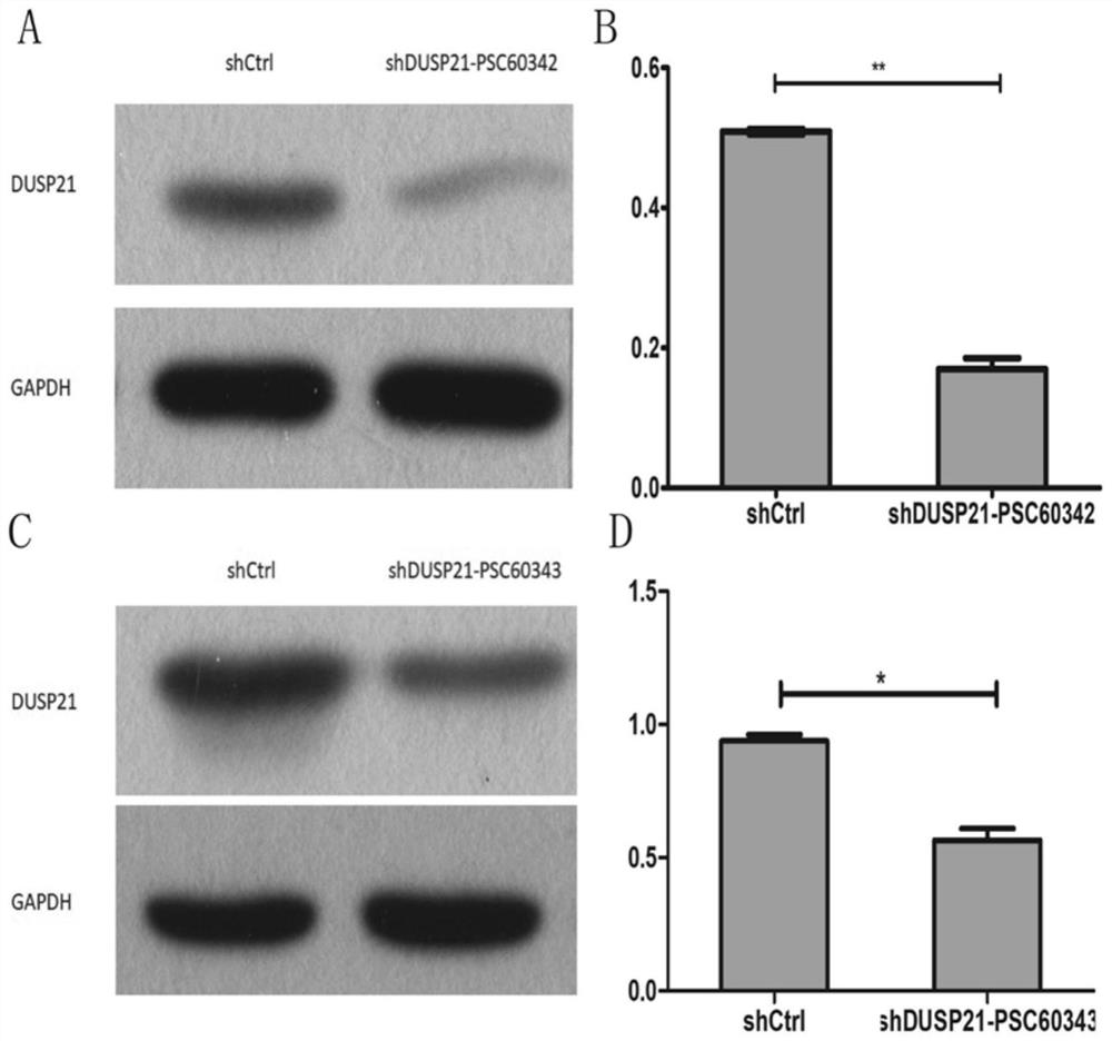 ShRNA for promoting apoptosis of imatinib-resistant chronic myeloid leukemia cell K562/G01 and application thereof