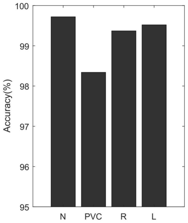 A ECG Signal Compression and Recognition Method Based on Singular Value Decomposition