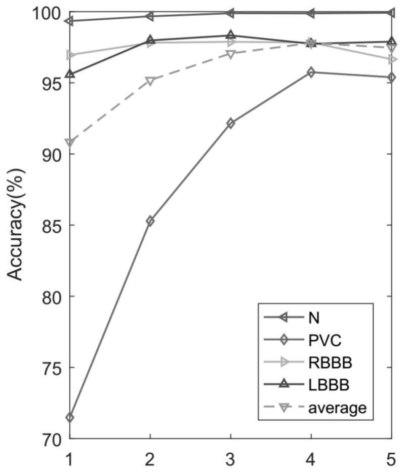 A ECG Signal Compression and Recognition Method Based on Singular Value Decomposition