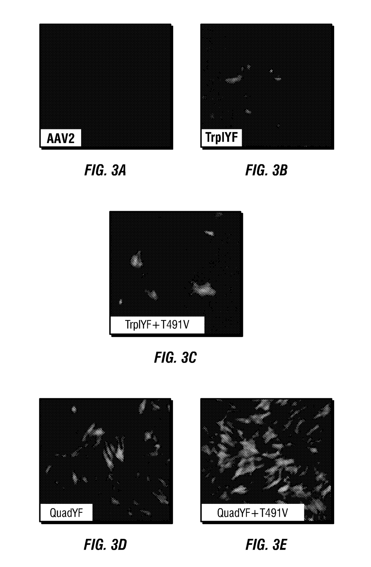 Raav vector compositions, methods for targeting vascular endothelial cells and use in treatment of type i diabetes