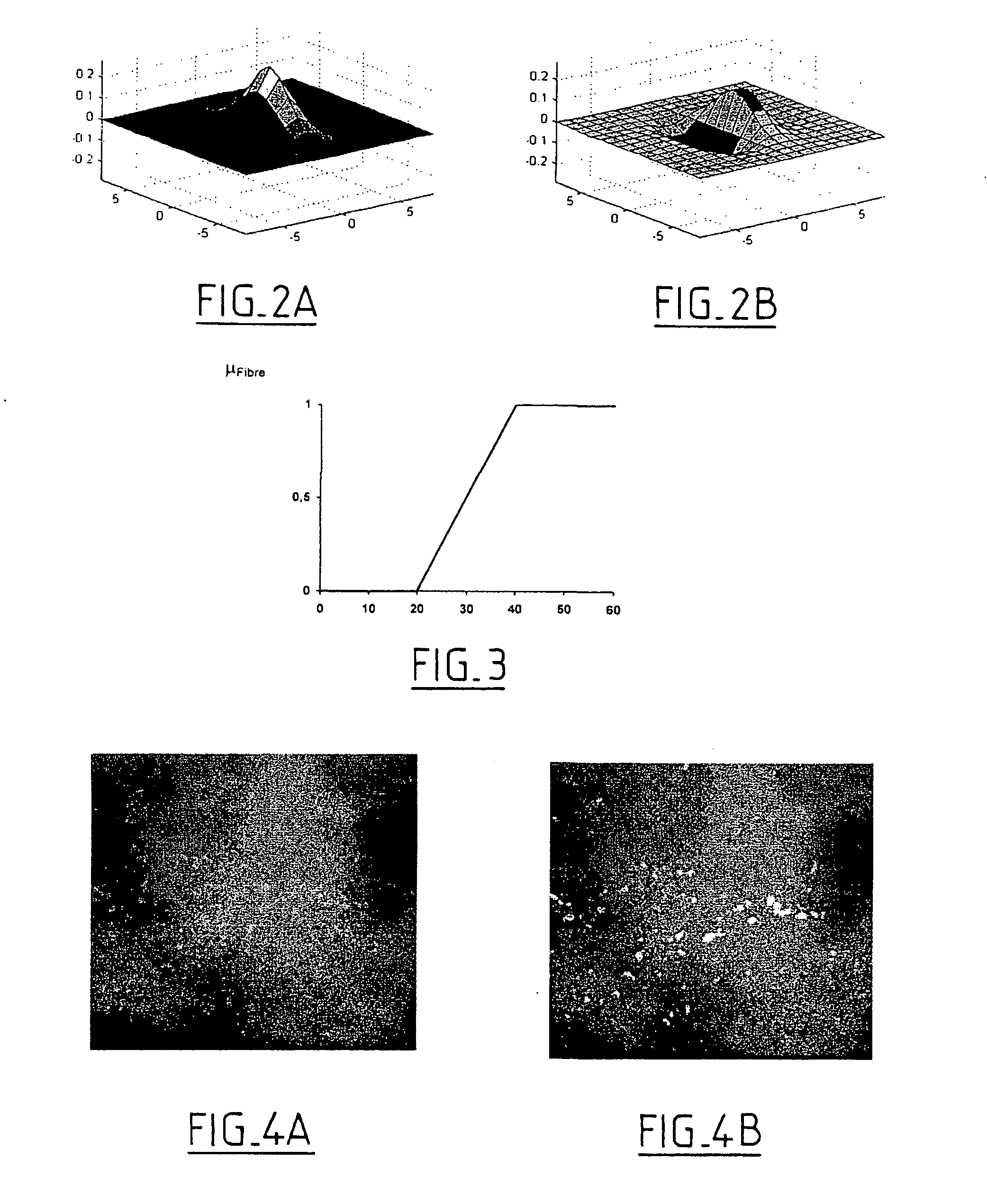 Method for radiological image processing