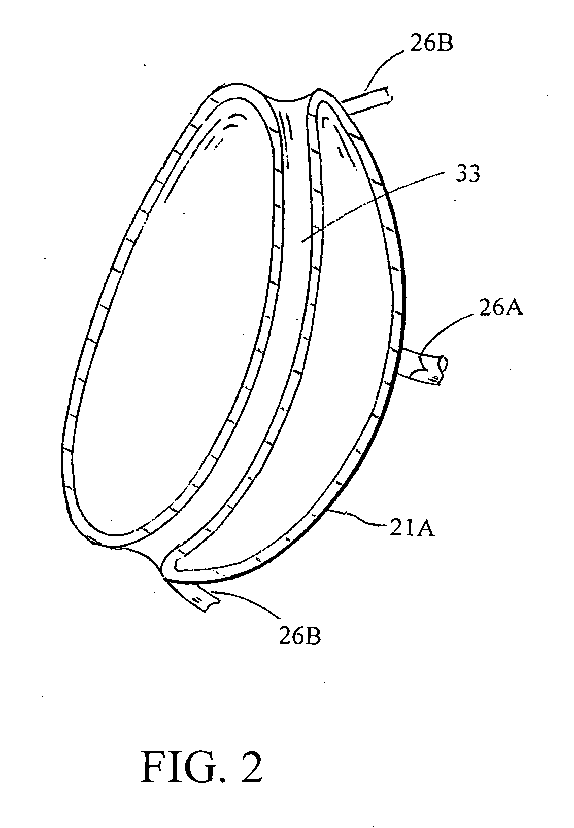 Intragastric space filler and methods of manufacture