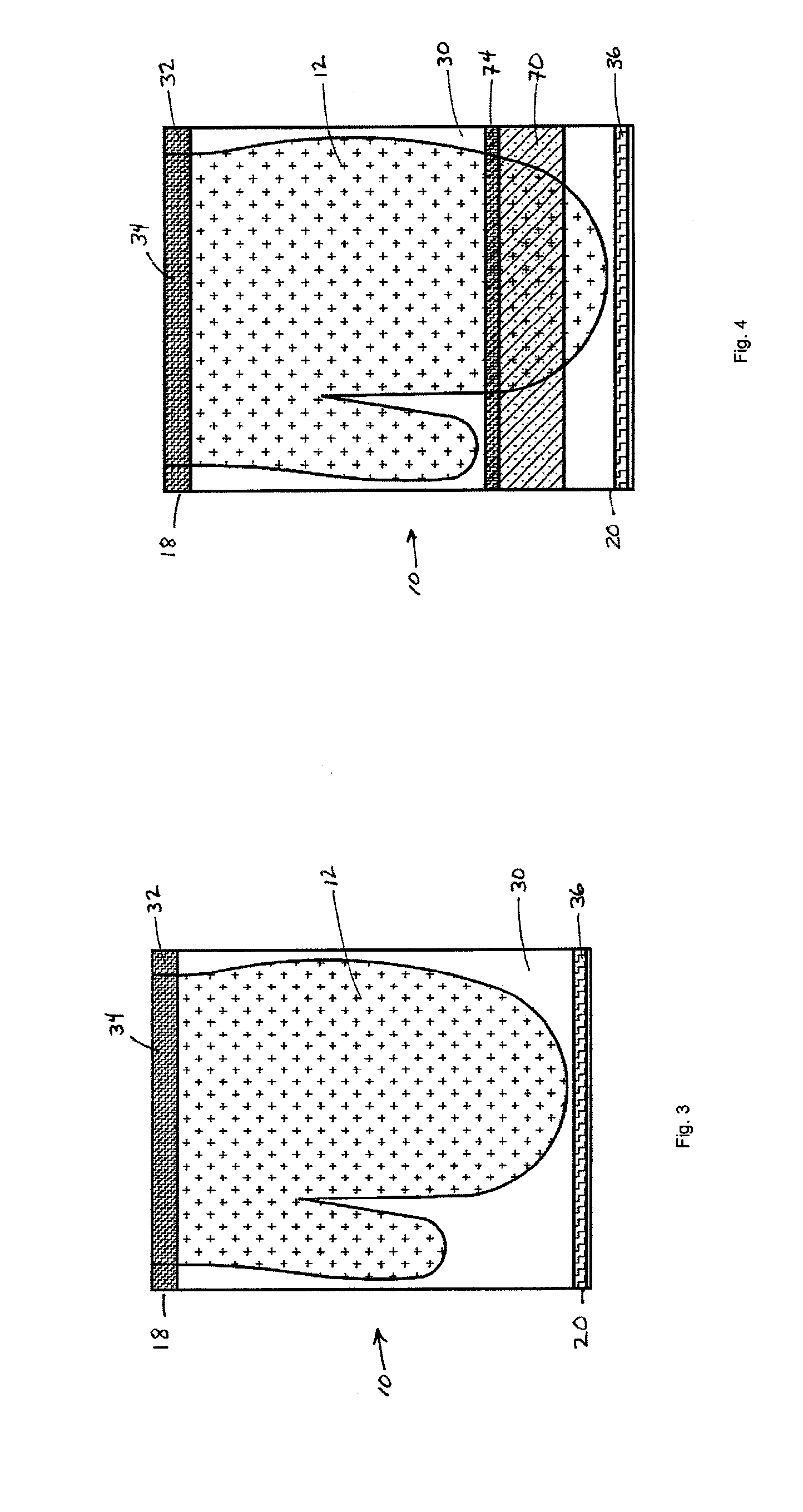 Antiseptic delivery system