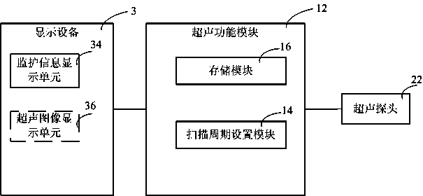 Monitoring equipment with ultrasonic scanning monitoring function, ultrasonic device and corresponding method