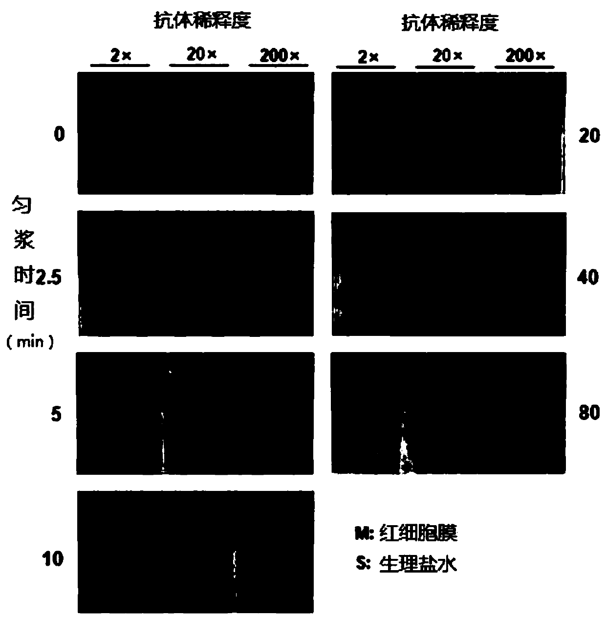 A kind of erythrocyte membrane and its preparation method and application