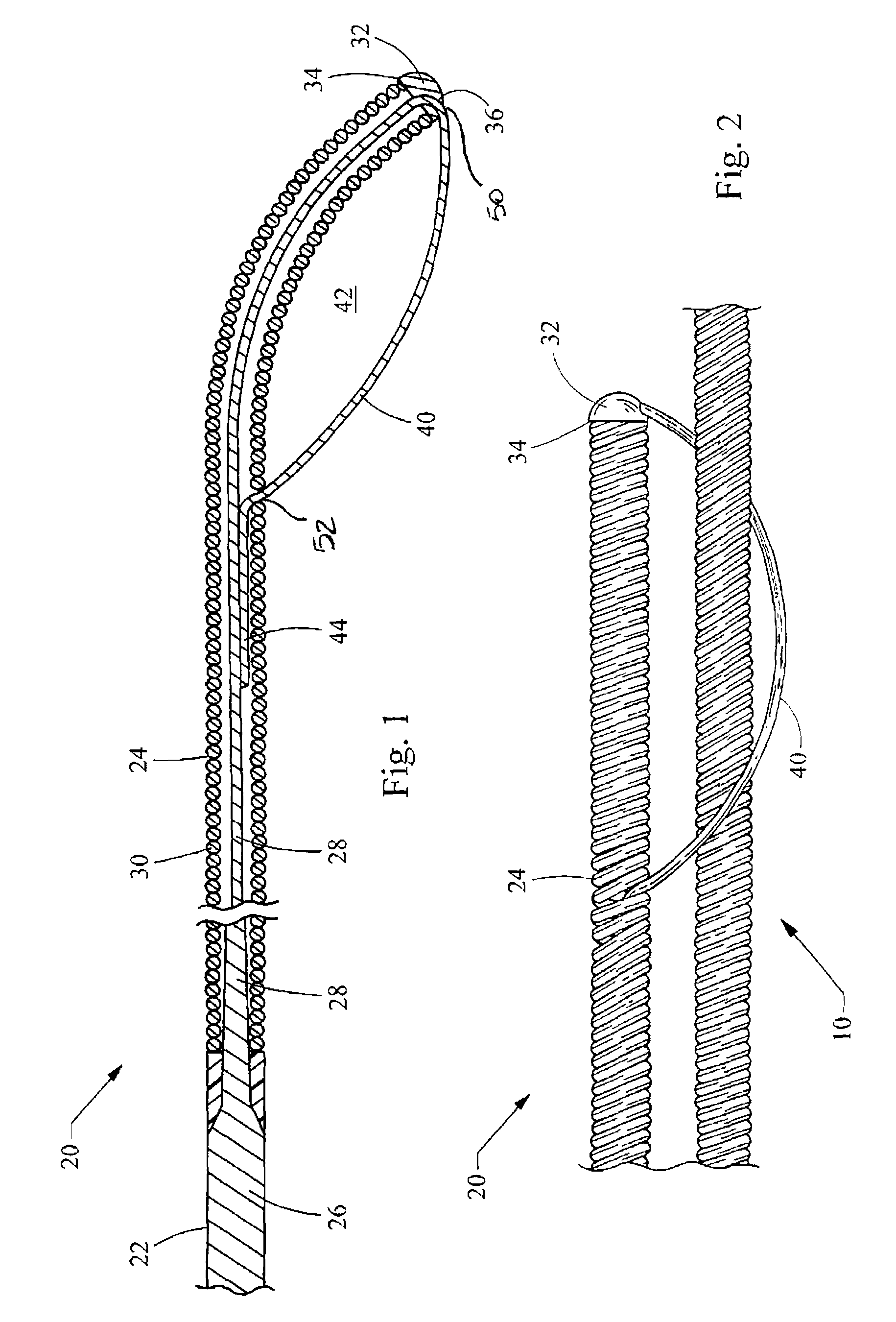 Coupling wire guide
