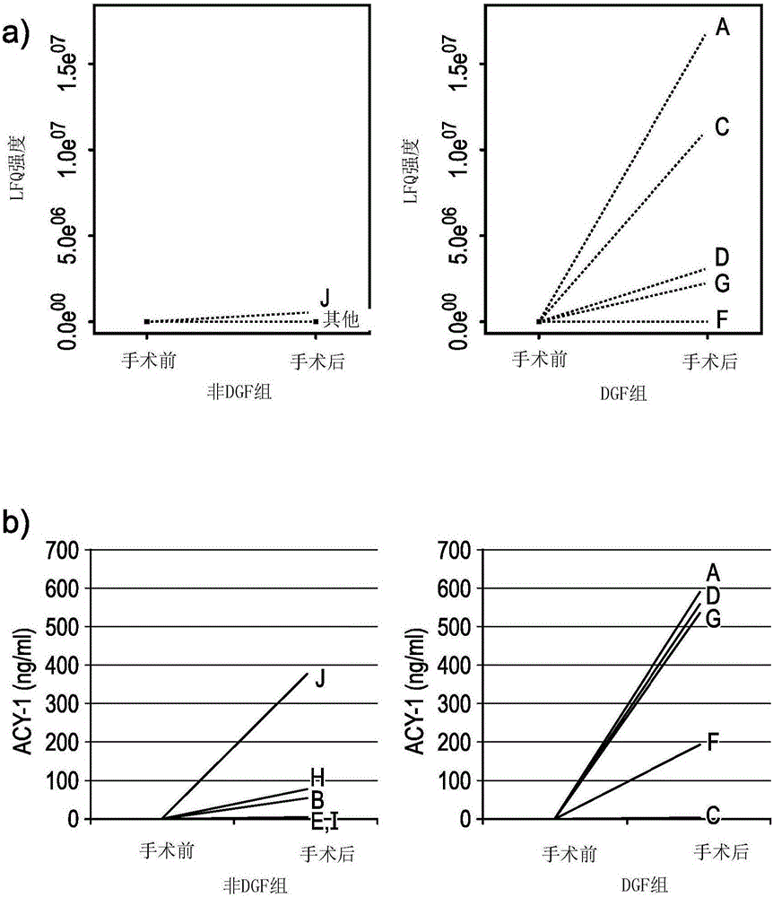 Use of ACY-1 as a marker of ischaemia/reperfusion, delayed graft function and graft viability as well as method thereof