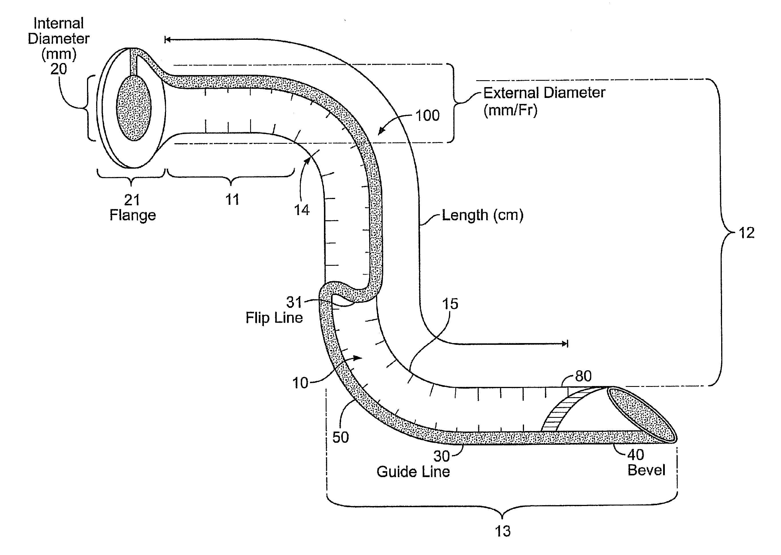 Devices and methods for nasoenteric intubation