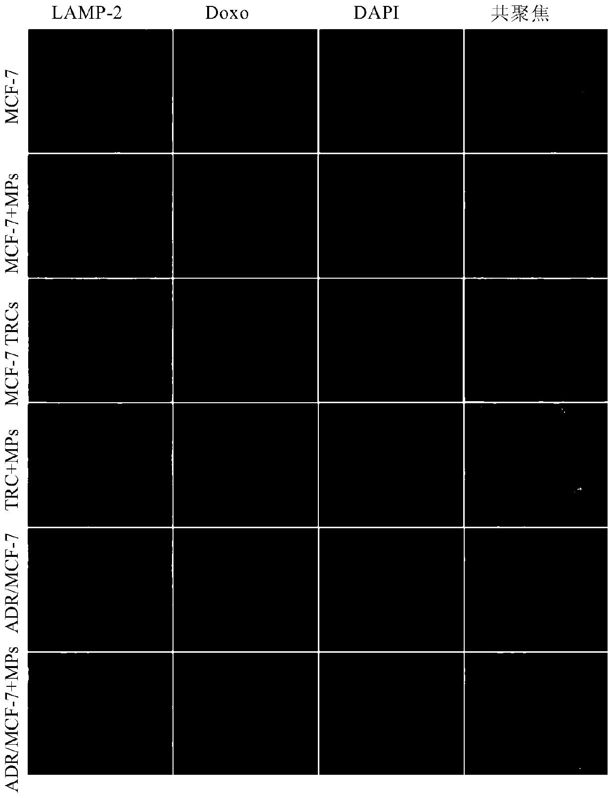 A kind of tumor chemotherapeutic drug preparation combination