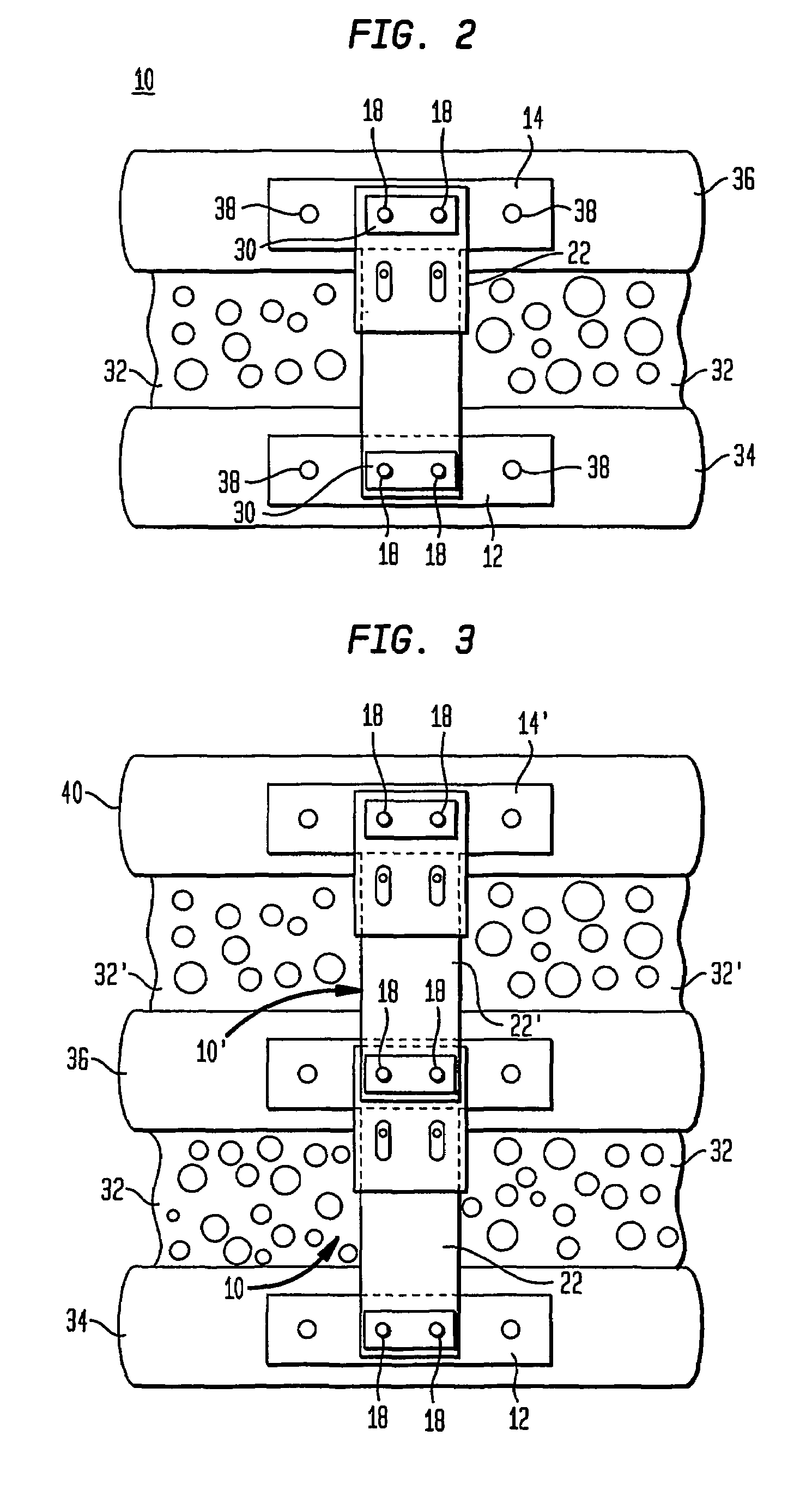 Mobile sleeve structure for maintaining spatial relationship between vertebrae