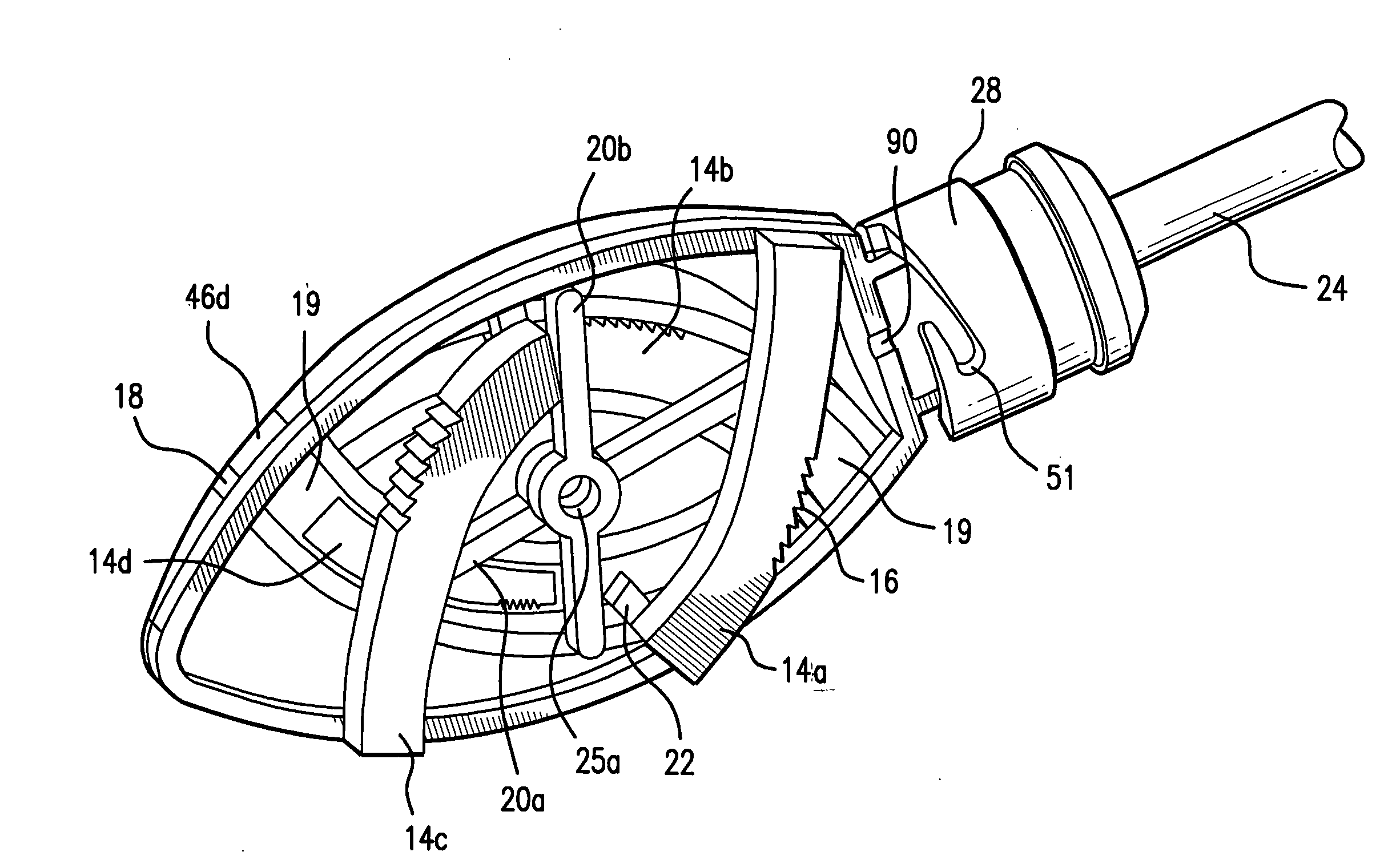 Interspinous implants and methods for implanting same