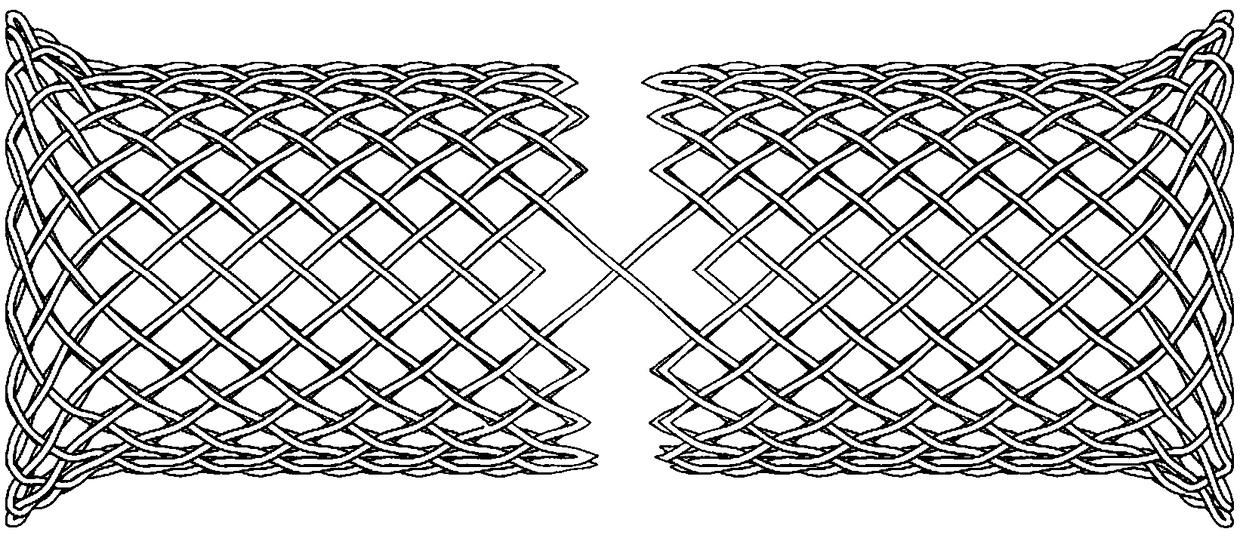 Sectional type esophageal stent and weaving method thereof