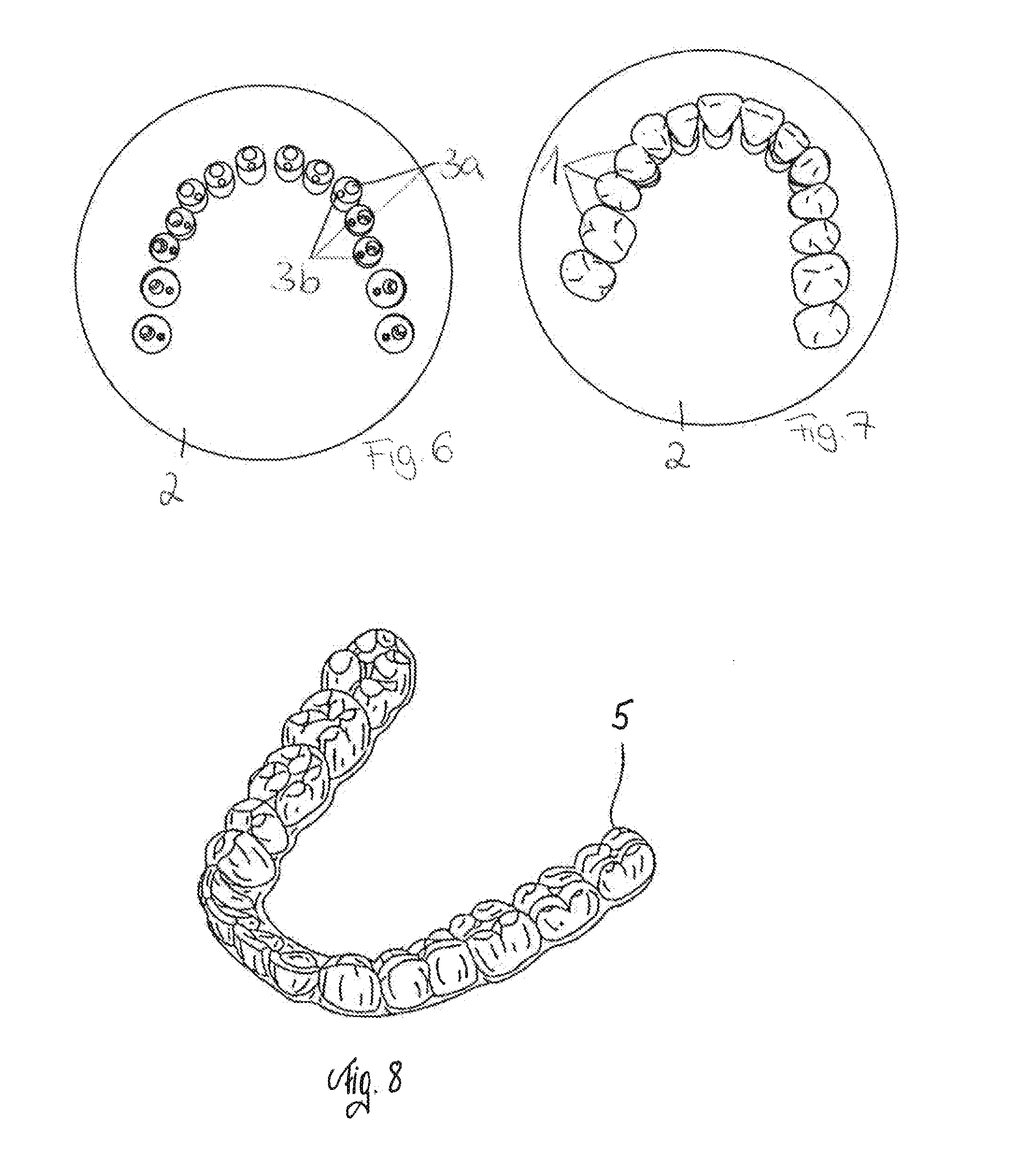 Method for producing a set of dental appliances for correcting tooth misalignments and orthodontic set-up model therefor