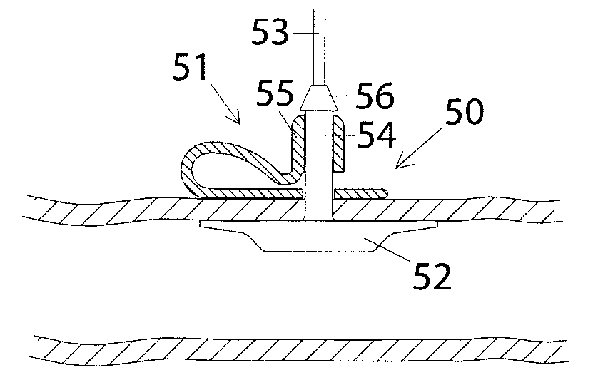 Method and device for sealing a puncture hole in a bodily organ